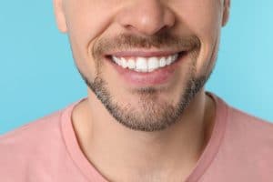 houston teeth whitening