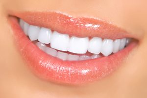 houston teeth whitening