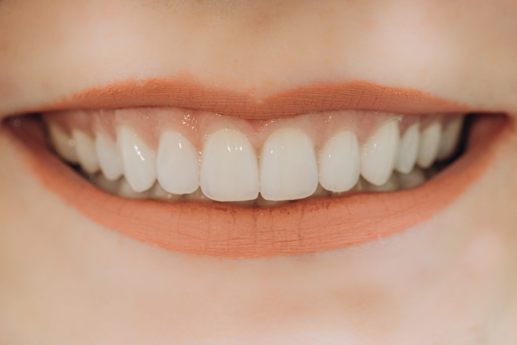 Porcelain Veneers Boost Your Smile’s Beauty Houston, TX