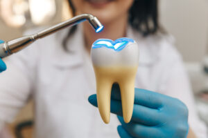 houston dental filling
