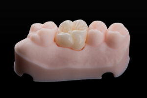 houston tx dental crowns