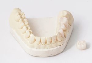 houston dental crown